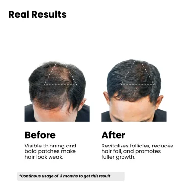 Result of Before and After using hair serum