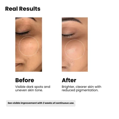 Before and After using peach fruit face wash result