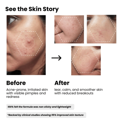 Face serum Result