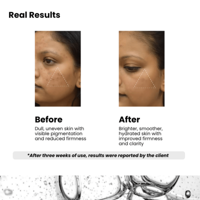 collagen cream result