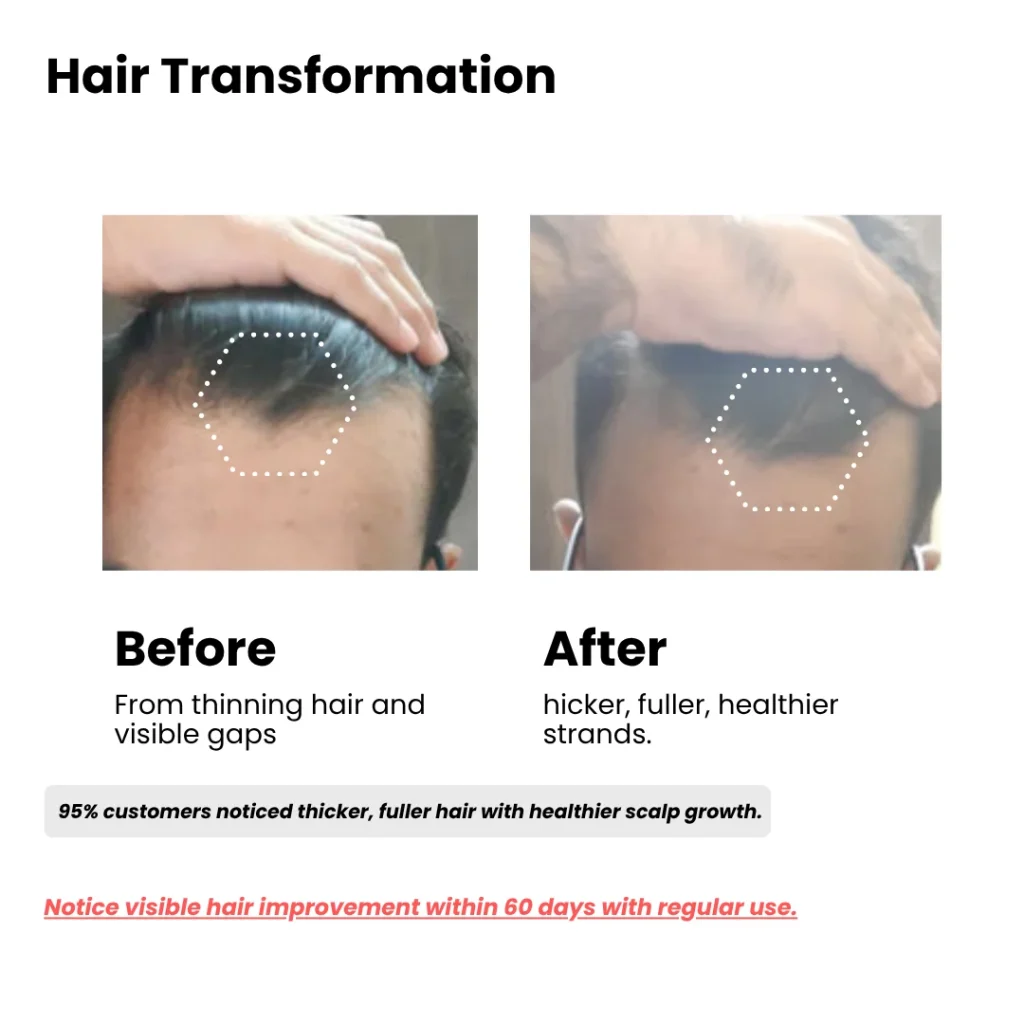 Before and after using the meni product result