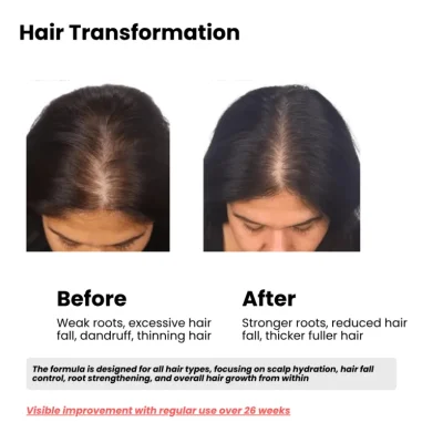 Meni Hair care transformation