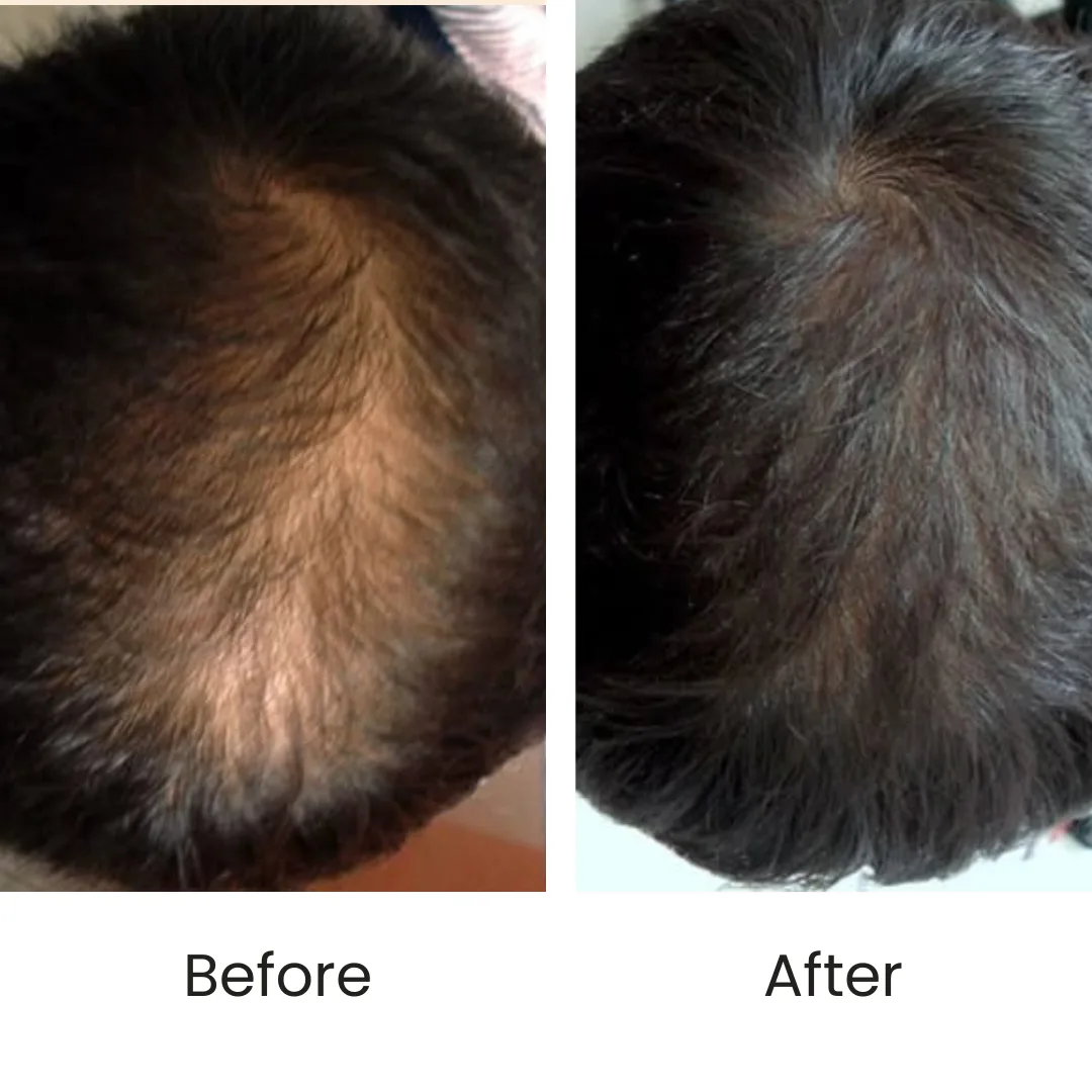 BEFORE AND AFTER