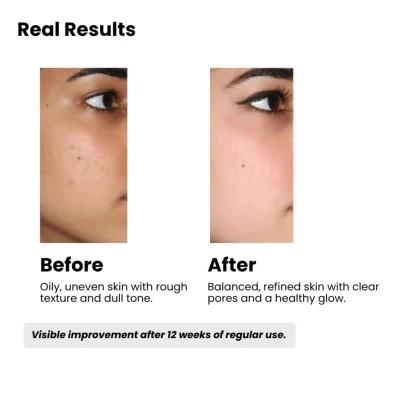 Meni before and after result