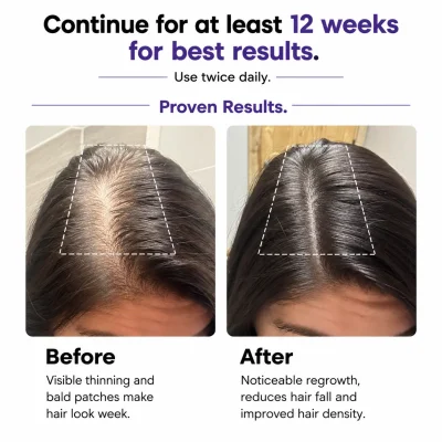 Before-and-after-result-hair-serum-women-